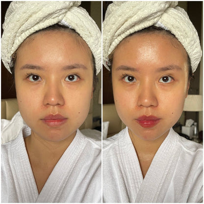 LumiDerm Pro