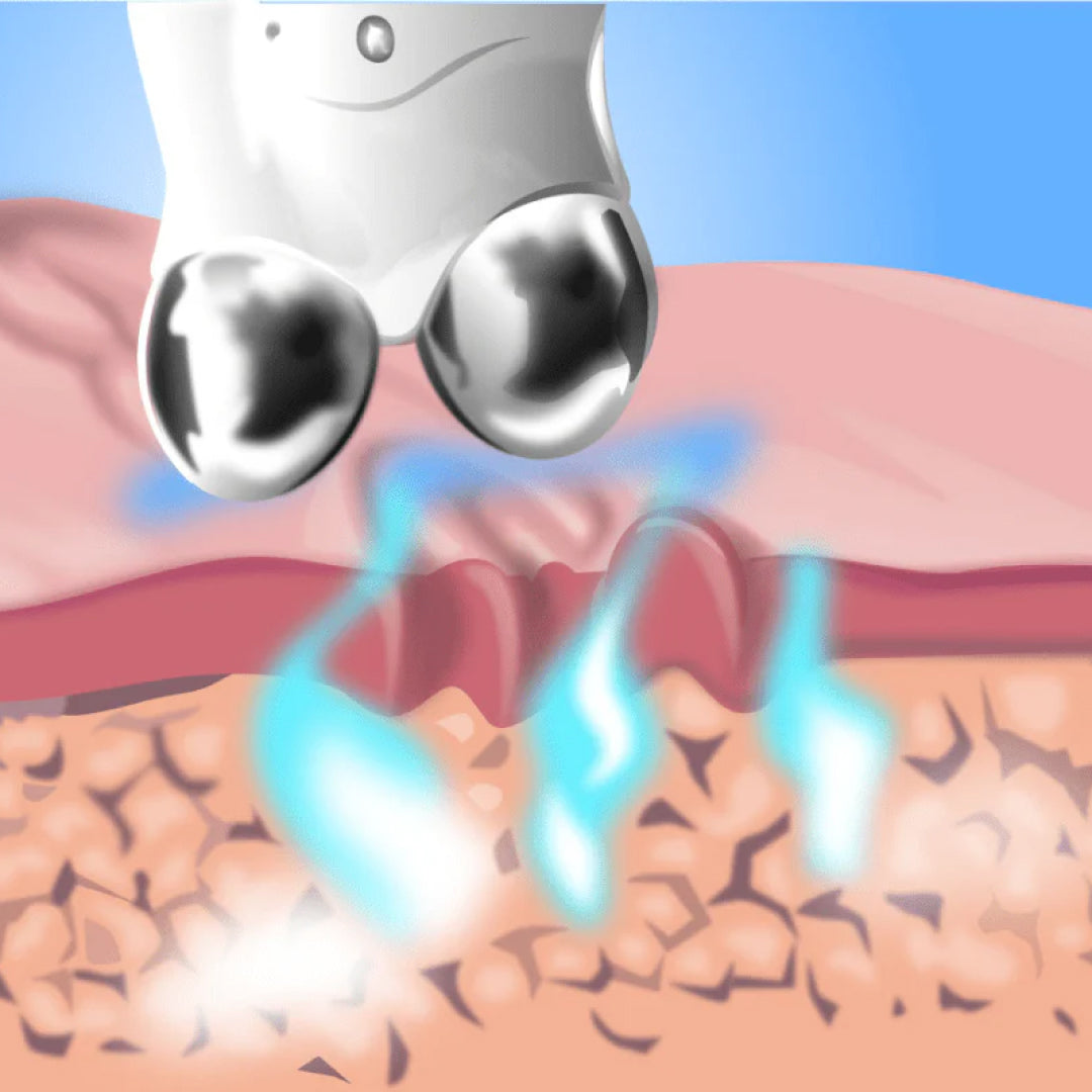 LumiDerm Pro