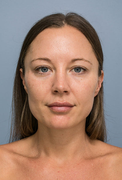 VisageLift