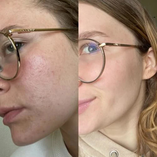 files/clinynose-img-27.jpg