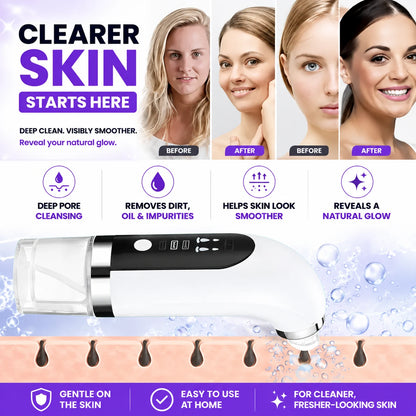 regen-dermasift-clinynose-img-10-regen