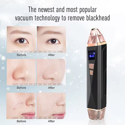 NovaDerm